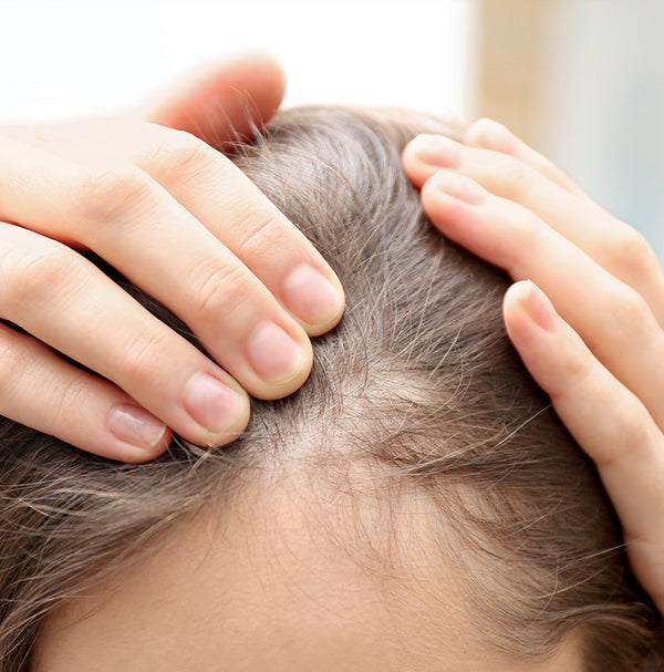 Hair Loss Causes and Treatments